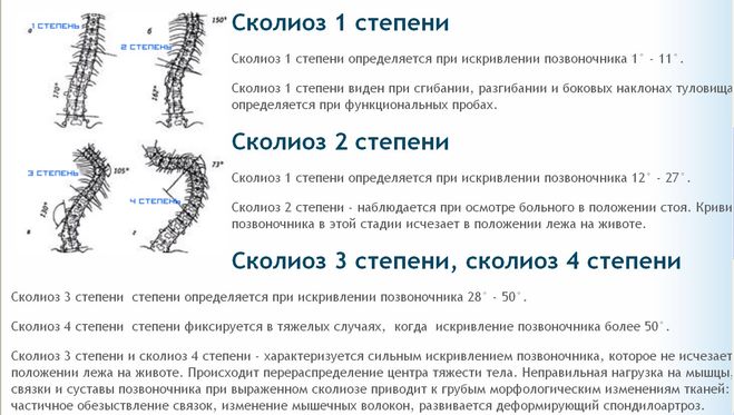 Степени болезни Разъяснение о возможных степенях искривления позвоночника