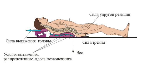 Действующие силы на пациента Механизм воздействия на позвоночник пациента