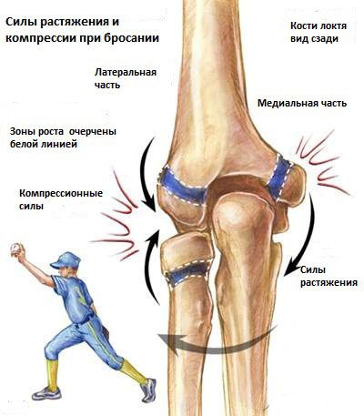 Травма локтя Почему возникает травма у спортсмена во время кидка