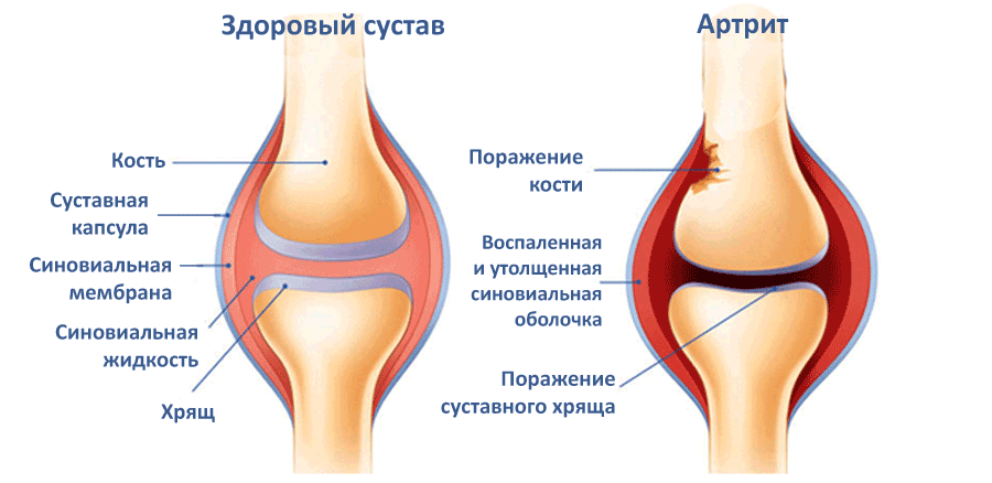 Клиника заболевания Проявление заболевания