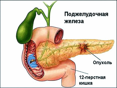 поджелудка человека, схема