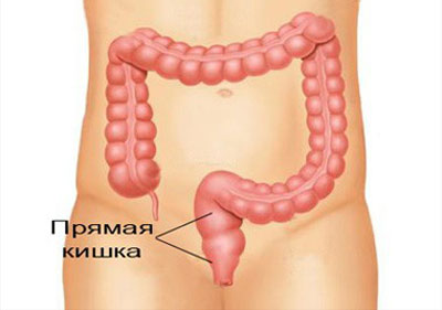 Расположение прямой кишки