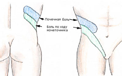 Печеночная боль