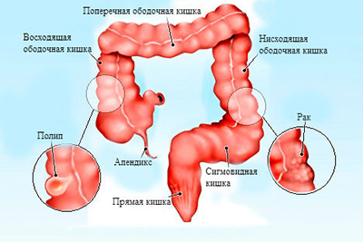 кишечник