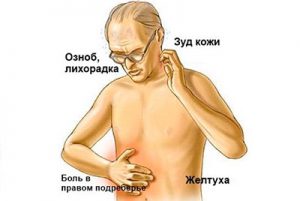 симптомы холестаза