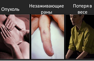 Картинка рака