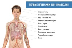 Первые признаки ВИЧ