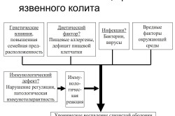 Причины неспецифического язвенного колита Причины неспецифического язвенного колита