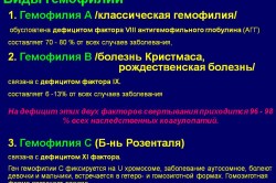 Виды гемофилий