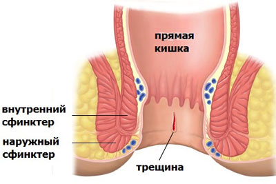 Внутренний и наружный сфинктеры