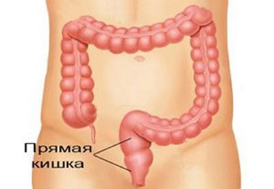 Прямая кишка человека