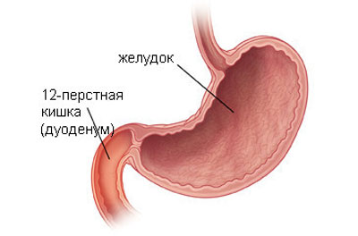Дуоденит двеннадцатиперстной кишки