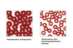 Количество эритроцитов в крови при анемии