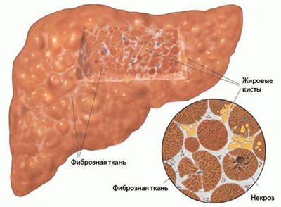 Картинка печени