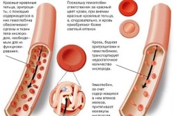 Кровь человека с железодефицитной анемией 