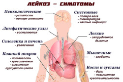 Симптомы лейкоза