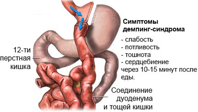 различные признаки демпингс