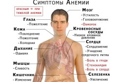 Симптомы анемии