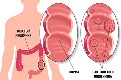 рисунок кишечника человека