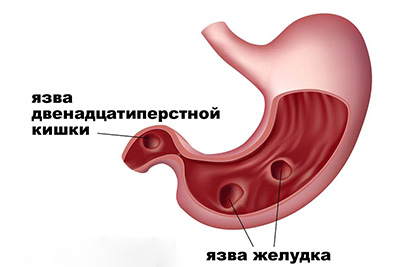 рисунок желудка
